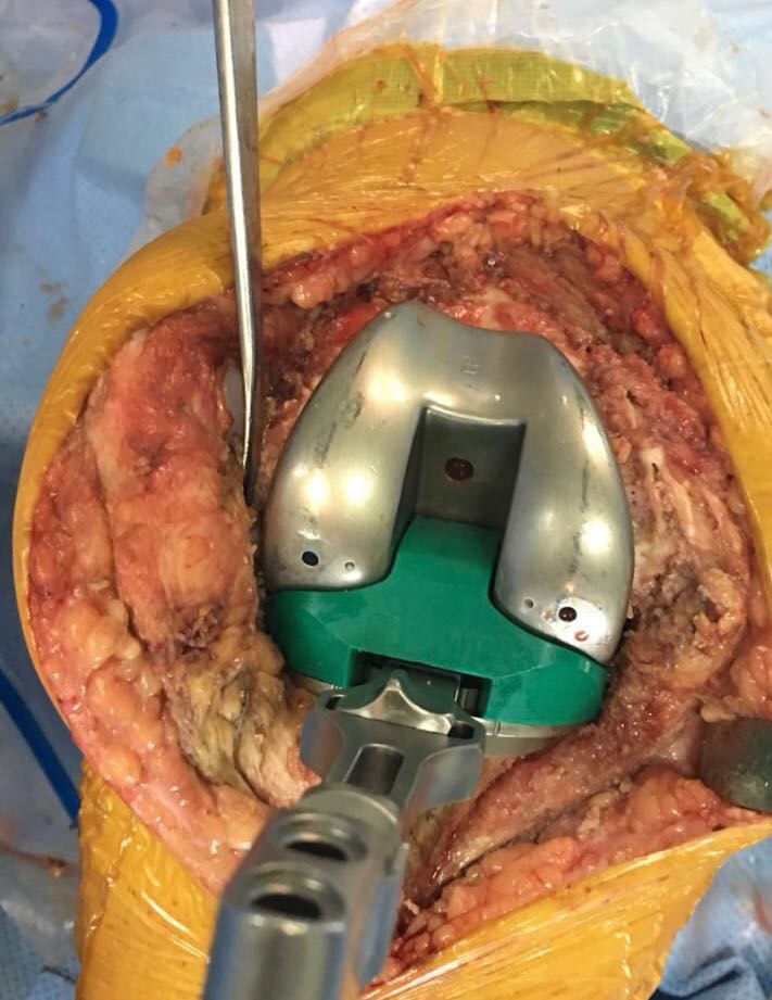 PTG de reprise d’essai (photo per-Operatoire)